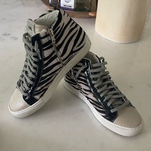 P448 Star Zebra High Top Sneakers